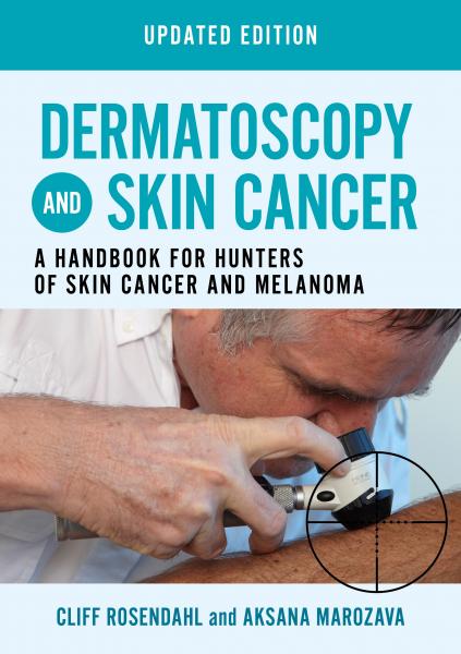 Dermatoscopy and Skin Cancer, updated edition: A handbook for hunters of skin cancer and melanoma(2023) - پوست